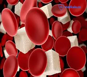 برای تست قندخون چه نکاتی را باید درنظر گرفت؟