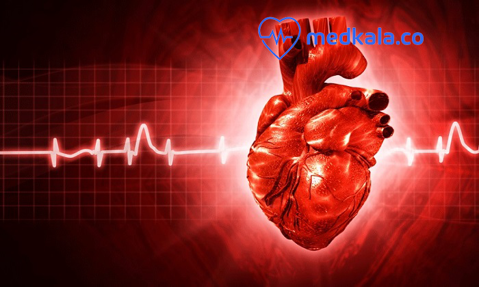  آنژیوگرافی چیست پیشگیری ازبیماری قلبی01