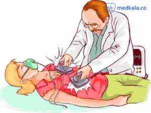 الکتروشوک درمانی چیست؟