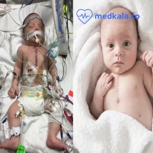 علل رایج ایست قلبی در نوزادان و کودکان چیست؟